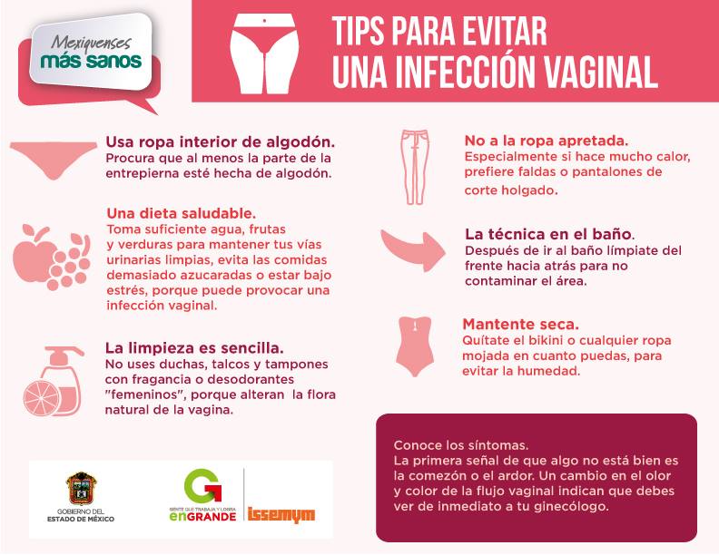 Infografía con tips para evitar una infección vaginal